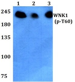 Invitrogen Phospho-WNK1 (Thr60) Polyclonal Antibody 100 &mu;L; Unconjugated:Antibodies,
