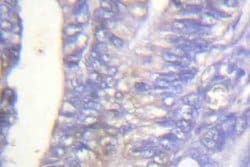 Invitrogen Phospho-PLCG2 (Tyr753) Polyclonal Antibody 100 &mu;L | Buy Online | Invitrogen&trade; | Fisher Scientific