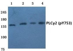 Invitrogen Phospho-PLCG2 (Tyr753) Polyclonal Antibody 100 &mu;L | Buy Online | Invitrogen&trade; | Fisher Scientific