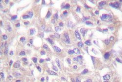 Invitrogen Phospho-alpha Adducin (Thr445) Polyclonal Antibody 100 &mu;L;