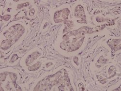 Invitrogen Phospho-ATP1A1 (Ser16) Polyclonal Antibody 100 &mu;L | Buy Online | Invitrogen&trade; | Fisher Scientific