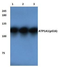 Invitrogen Phospho-ATP1A1 (Ser16) Polyclonal Antibody 100 &mu;L | Buy Online | Invitrogen&trade; | Fisher Scientific