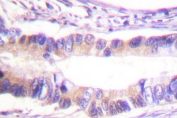 Invitrogen Phospho-c-Cbl (Tyr674) Polyclonal Antibody 100 &mu;L; Unconjugated:Antibodies,