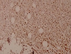 Phospho-MDM2 (Ser166) Polyclonal Antibody:Antibodies, Polyclonal
