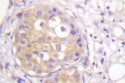 Invitrogen Phospho-FGFR1 (Tyr766) Polyclonal Antibody 100 &mu;L; Unconjugated:Antibodies,