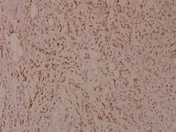 Invitrogen Phospho-MiTF (Ser180) Polyclonal Antibody 100 &mu;L; Unconjugated:Antibodies,