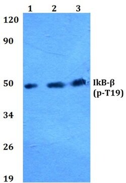 Phospho-IkB beta (Thr19) Polyclonal Antibody:Antibodies, Polyclonal