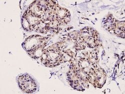 Invitrogen Phospho-ERK1/ERK2 (Tyr204) Polyclonal Antibody 100 &mu;L; Unconjugated:Antibodies,