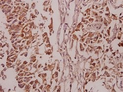 Invitrogen Phospho-PKC delta (Ser645) Polyclonal Antibody 100 &mu;L | Buy Online | Invitrogen&trade; | Fisher Scientific