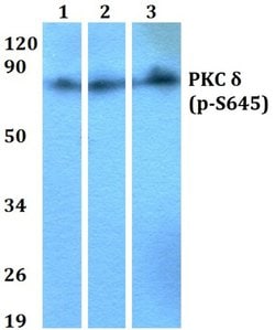 Invitrogen Phospho-PKC delta (Ser645) Polyclonal Antibody 100 &mu;L | Buy Online | Invitrogen&trade; | Fisher Scientific