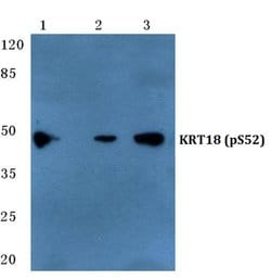 Invitrogen Phospho-Cytokeratin 18 (Ser52) Polyclonal Antibody 100 &mu;L;