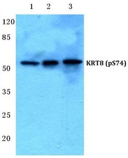Invitrogen Phospho-Cytokeratin 8 (Ser74) Polyclonal Antibody 100 &mu;L;