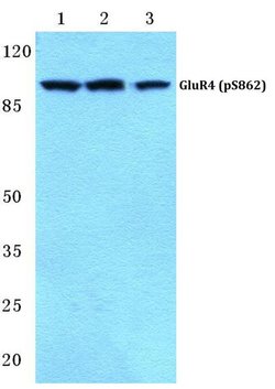 Invitrogen Phospho-GluR4 (Ser862) Polyclonal Antibody 100 &mu;L | Buy Online | Invitrogen&trade; | Fisher Scientific