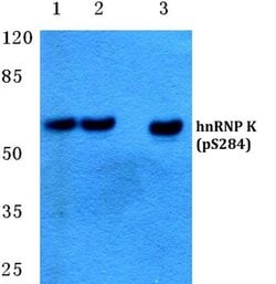 Invitrogen Phospho-hnRNP K (Ser284) Polyclonal Antibody 100 &mu;L; Unconjugated:Antibodies,