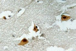 Invitrogen Phospho-FOXO4 (Ser197) Polyclonal Antibody 100 &mu;L; Unconjugated:Antibodies,