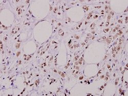 Invitrogen Phospho-AKT2 (Ser474) Polyclonal Antibody 100 &mu;L; Unconjugated:Antibodies,