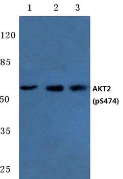 Invitrogen Phospho-AKT2 (Ser474) Polyclonal Antibody 100 &mu;L; Unconjugated:Antibodies,
