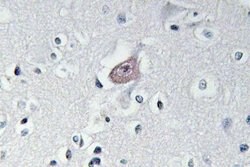 Invitrogen Phospho-ABL1/ABL2 (Tyr393, Tyr439) Polyclonal Antibody 100 &mu;L;