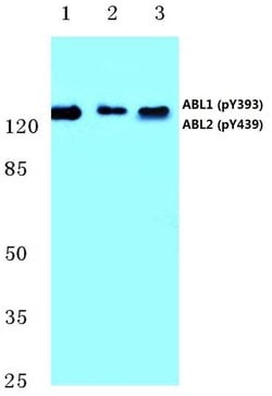 Invitrogen Phospho-ABL1/ABL2 (Tyr393, Tyr439) Polyclonal Antibody 100 &mu;L;