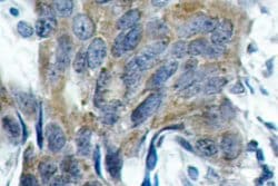 Invitrogen Phospho-beta Catenin (Ser33) Polyclonal Antibody 100 &mu;L;