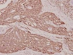Invitrogen Phospho-beta Catenin (Ser37) Polyclonal Antibody 100 &mu;L;