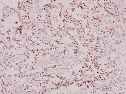Invitrogen Phospho-BRCA1 (Ser1423) Polyclonal Antibody 100 &mu;L; Unconjugated:Antibodies,