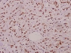 Invitrogen Phospho-JNK1/JNK2/JNK3 (Thr183) Polyclonal Antibody 100 &mu;L;