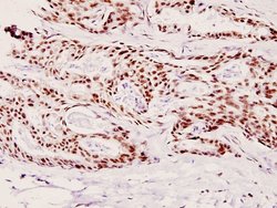 Phospho-p70 S6 Kinase (Thr421), Polyclonal, Invitrogen 100&mu;L; Unconjugated:Antibodies,