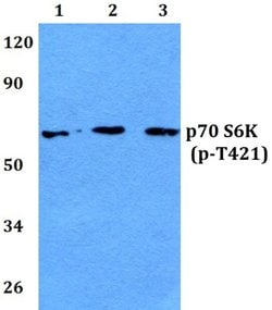 Phospho-p70 S6 Kinase (Thr421), Polyclonal, Invitrogen 100&mu;L; Unconjugated:Antibodies,