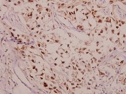 Invitrogen Phospho-CPI-17 (Thr38) Polyclonal Antibody 100 &mu;L; Unconjugated:Antibodies,