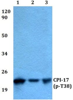 Invitrogen Phospho-CPI-17 (Thr38) Polyclonal Antibody 100 &mu;L; Unconjugated:Antibodies,