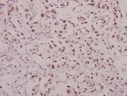 Invitrogen Phospho-GluR1 (Ser863) Polyclonal Antibody 100 &mu;L; Unconjugated:Antibodies,