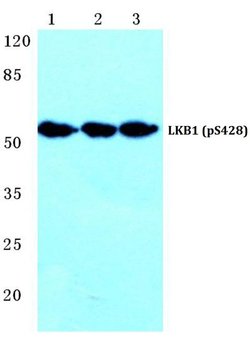 Phospho-LKB1 (Ser428) Polyclonal Antibody:Antibodies, Polyclonal