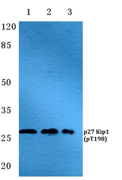 Invitrogen Phospho-p27 Kip1 (Thr198) Polyclonal Antibody 100 &mu;L; Unconjugated:Antibodies,