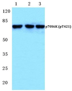 Phospho-p70 S6 Kinase (Thr421) Polyclonal Antibody:Antibodies, Polyclonal