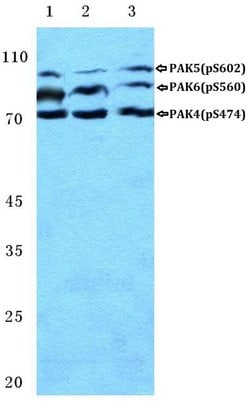 Invitrogen Phospho-PAK4/6/7 (Ser474) Polyclonal Antibody 100 &mu;L; Unconjugated:Antibodies,