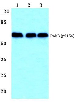 Invitrogen Phospho-PAK3 (Ser154) Polyclonal Antibody 100 &mu;L | Buy Online | Invitrogen&trade; | Fisher Scientific