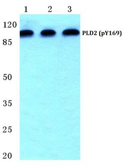 Invitrogen Phospho-PLD2 (Tyr169) Polyclonal Antibody 100 &mu;L | Buy Online | Invitrogen&trade; | Fisher Scientific