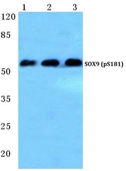 Phospho-SOX9 (Ser181) Polyclonal Antibody:Antibodies, Polyclonal