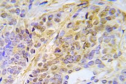 Invitrogen Phospho-CHK2 (Thr387) Polyclonal Antibody 100 &mu;L; Unconjugated:Antibodies,