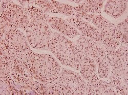 Invitrogen Phospho-HDAC1 (Ser421, Ser423) Polyclonal Antibody 100 &mu;L | Buy Online | Invitrogen&trade; | Fisher Scientific