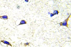 Invitrogen LIMK1/LIMK2 Polyclonal Antibody 100 μL; Unconjugated:Antibodies,