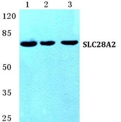 Invitrogen SLC28A2 Polyclonal Antibody 100 &mu;L; Unconjugated:Antibodies,
