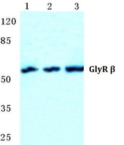Invitrogen GLRB Polyclonal Antibody 100 &mu;L; Unconjugated:Antibodies,