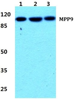 Invitrogen MPP9 Polyclonal Antibody 100 &mu;L | Buy Online | Invitrogen&trade; | Fisher Scientific