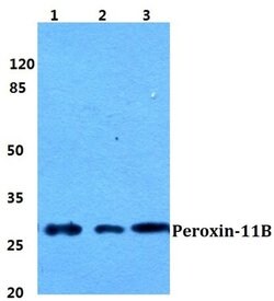 Invitrogen PEX11B Polyclonal Antibody 100 &mu;L; Unconjugated:Antibodies,