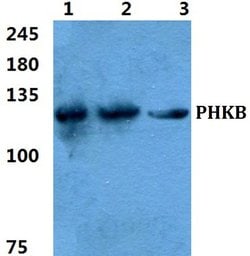 Invitrogen PHKB Polyclonal Antibody 100 &mu;L; Unconjugated:Antibodies,