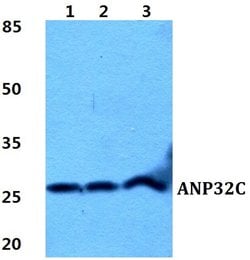 Invitrogen ANP32C Polyclonal Antibody 100 &mu;L; Unconjugated:Antibodies,