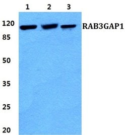 Invitrogen RAB3GAP1 Polyclonal Antibody 100 &mu;L | Buy Online | Invitrogen&trade; | Fisher Scientific