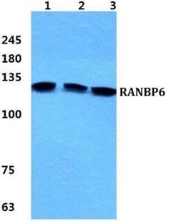 Invitrogen RANBP6 Polyclonal Antibody 100 &mu;L; Unconjugated:Antibodies,